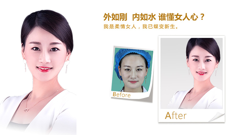 安顺V脸、线雕隆鼻